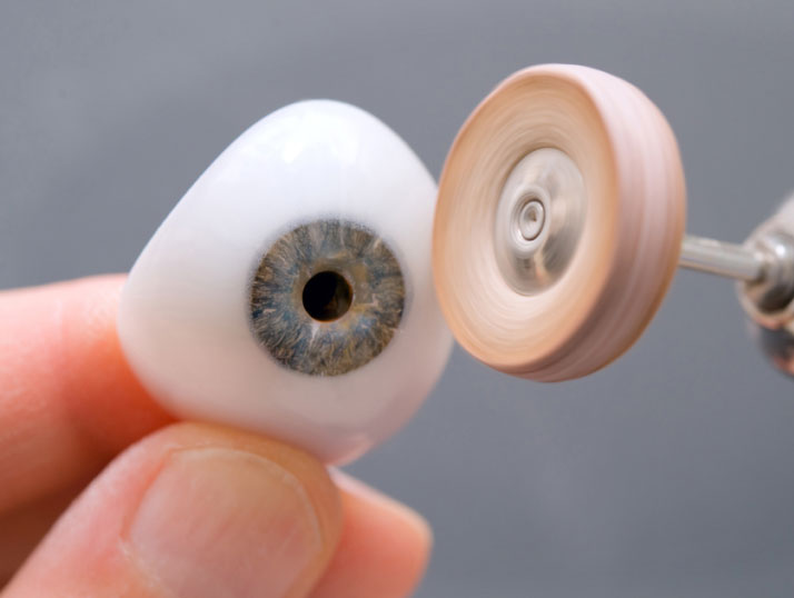 Prótesis ocular